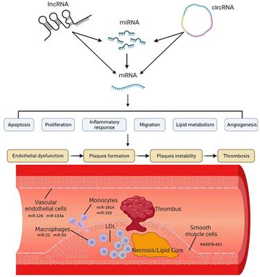 Non-coding RNAs are key players and promising therapeutic targets in atherosclerosis